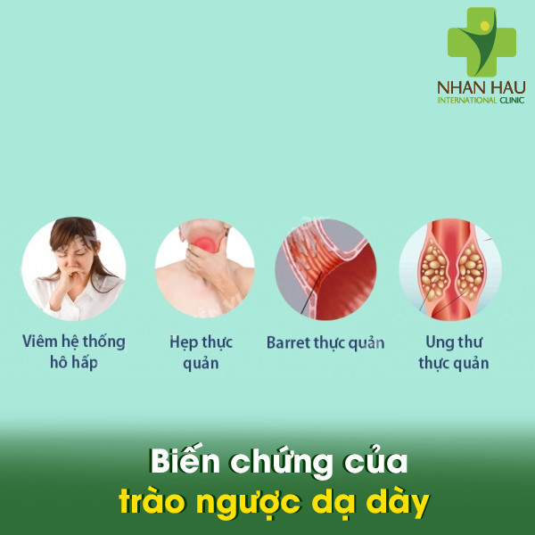 Trào ngược dạ dày là gì? triệu chứng, nguyên nhân và cách điều trị 7 Biến chứng của trào ngược dạ dày