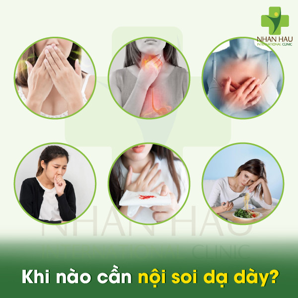 Nội soi dạ dày là gì: Ưu điểm và nhược điểm của nội soi dạ dày 3 Khi nào cần nội soi dạ dày