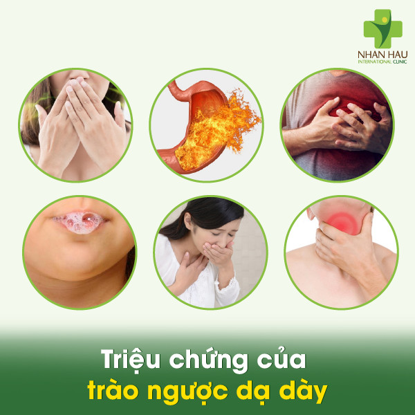 Mẹo Chữa Trào Ngược Dạ Dày Tại Nhà: Cách Giảm Triệu Chứng và Khắc Phục 2 Triệu chứng của trào ngược dạ dày