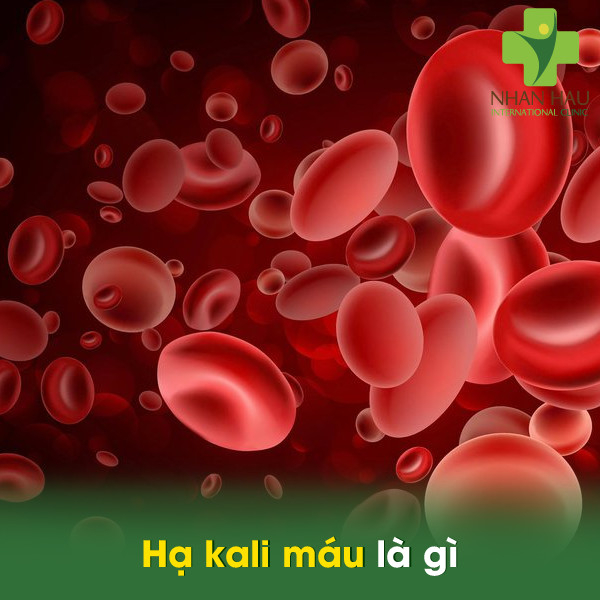 Hạ kali máu và những nguyên nhân hạ kali máu 2 Hạ kali máu là gì