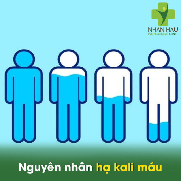 Hạ kali máu và những nguyên nhân hạ kali máu 3 Nguyên nhân hạ kali máu