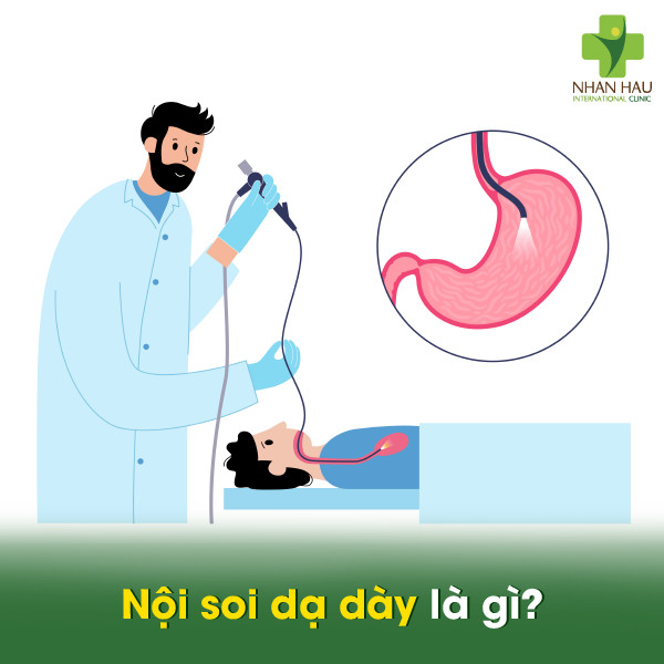 Trào ngược dạ dày là gì? triệu chứng, nguyên nhân và cách điều trị 8 bác sĩ đưa ống nội soi mềm qua miệng bệnh nhân để quan sát thực quản, dạ dày và tá tràng