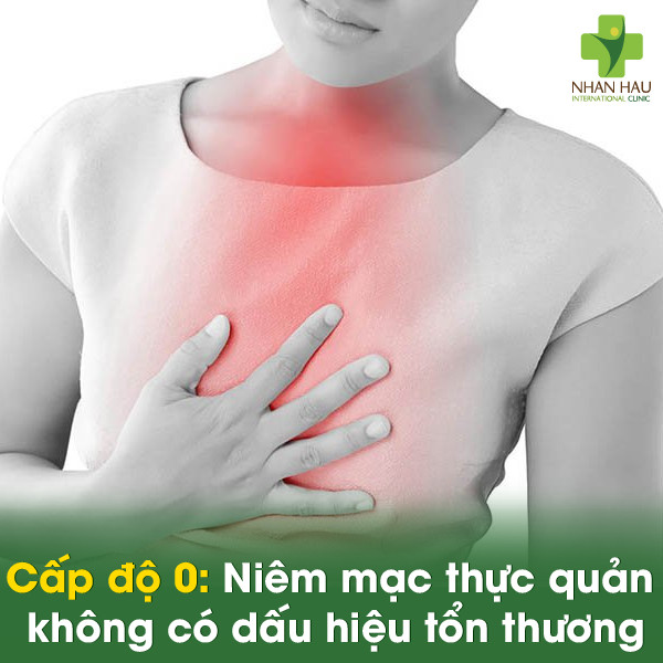 Cấp độ 0: Niêm mạc thực quản không có dấu hiệu tổn thương.