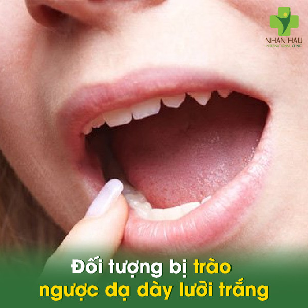 Trào ngược dạ dày lưỡi trắng: Nguyên nhân, triệu chứng và cách điều trị 4 Đối tượng bị trào ngược dạ dày lưỡi trắng
