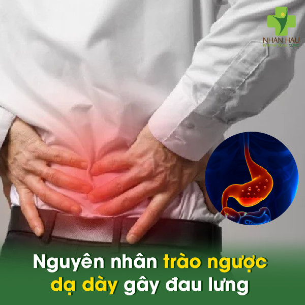 Nguyên nhân trào ngược dạ dày gây đau lưng và cách điều trị 1 Nguyên nhân trào ngược dạ dày gây đau lưng