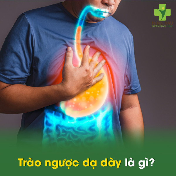 Cách làm sạch họng khi bị trào ngược dạ dày nhanh chóng 1 Trào ngược dạ dày là gì?