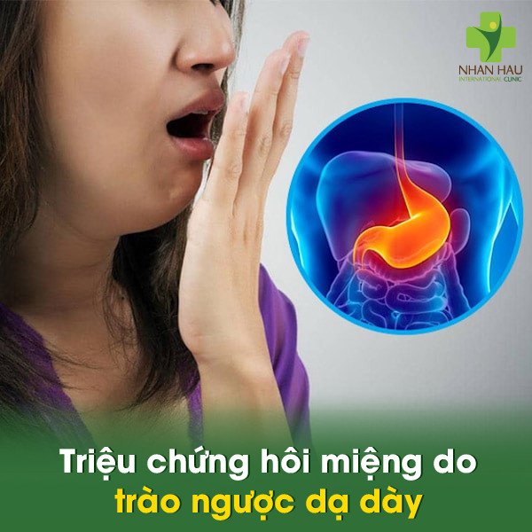 Nguyên nhân trào ngược dạ dày gây hôi miệng và cách điều trị 2 Triệu chứng hôi miệng do trào ngược dạ dày