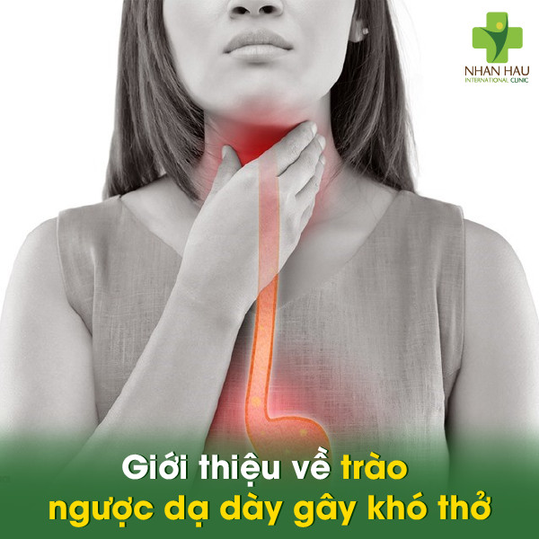 Trào ngược dạ dày gây khó thở: Nguyên nhân, triệu chứng và cách điều trị 1 Giới thiệu về trào ngược dạ dày gây khó thở