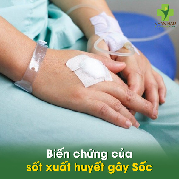 Biến chứng sốt xuất huyết: Hậu quả đáng lo ngại 3 Biến chứng của sốt xuất huyết gây Sốc
