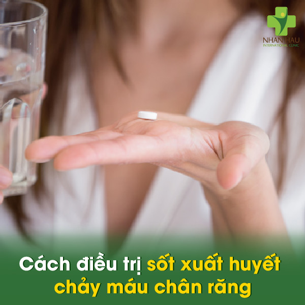 Sốt xuất huyết chảy máu chân răng: Nguyên nhân, triệu chứng, cách phòng ngừa và điều trị 4 Cách điều trị sốt xuất huyết chảy máu chân răng