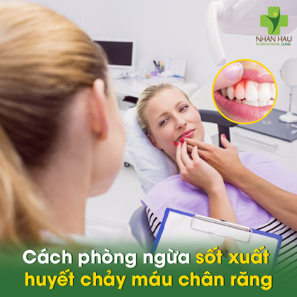 Sốt xuất huyết chảy máu chân răng: Nguyên nhân, triệu chứng, cách phòng ngừa và điều trị 3 Cách phòng ngừa sốt xuất huyết chảy máu chân răng