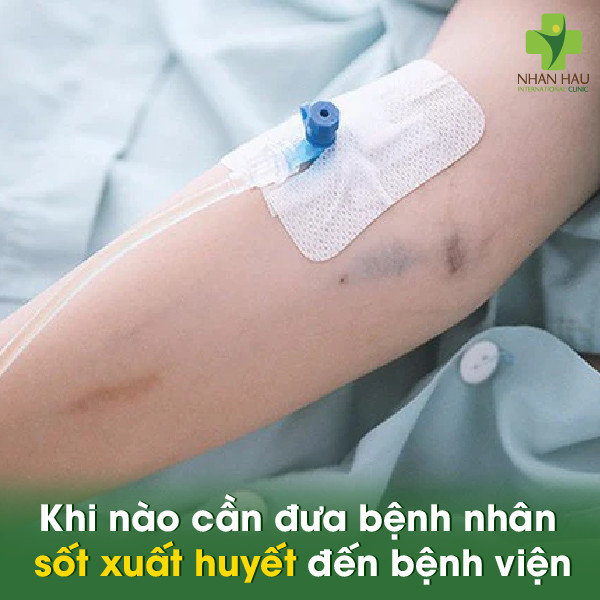 Kế hoạch chăm sóc bệnh nhân sốt xuất huyết và những điều cần lưu ý 5 Khi nào cần đưa bệnh nhân sốt xuất huyết đến bệnh viện