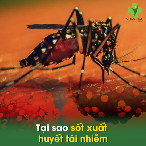 Sốt xuất huyết có bị lại không? Tái nhiễm có nguy hiểm không? 1 Tại sao sốt xuất huyết tái nhiễm