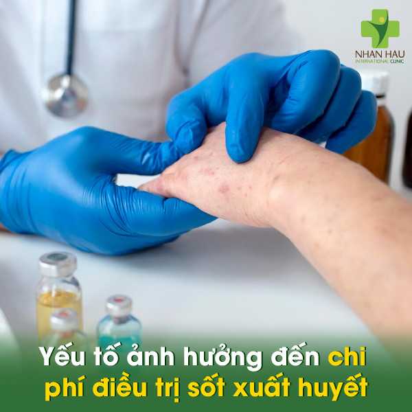 Yếu tố ảnh hưởng đến chi phí điều trị sốt xuất huyết
