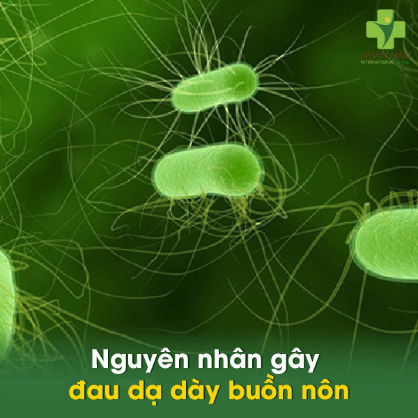 Đau dạ dày buồn nôn: Nguyên nhân, triệu chứng và cách điều trị 1 Nguyên nhân gây đau dạ dày buồn nôn