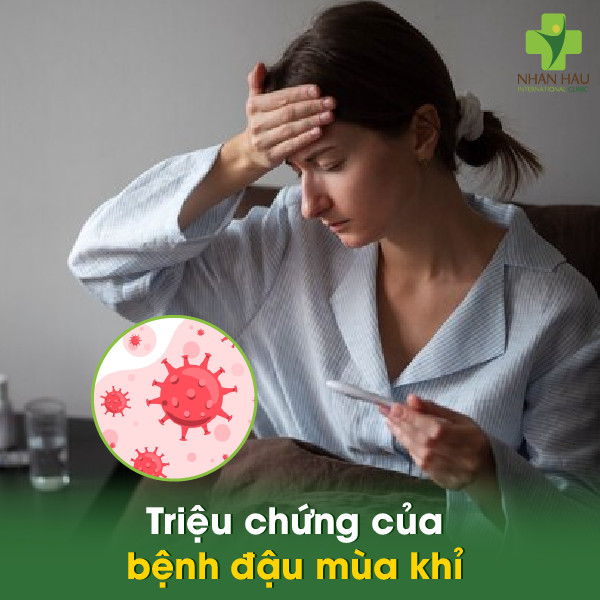 Bệnh đậu mùa khỉ: Nguyên nhân, triệu chứng, cách phòng tránh 3 Triệu chứng của bệnh đậu mùa khỉ