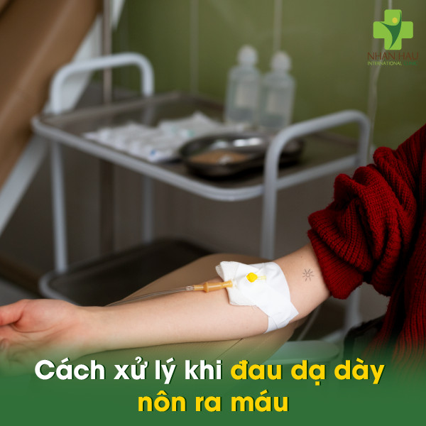 Đau dạ dày nôn ra máu: Nguyên nhân, Triệu chứng và cách xử lý 4 Cách xử lý khi đau dạ dày nôn ra máu