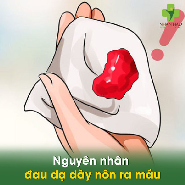 Đau dạ dày nôn ra máu: Nguyên nhân, Triệu chứng và cách xử lý 1 Nguyên nhân đau dạ dày nôn ra máu
