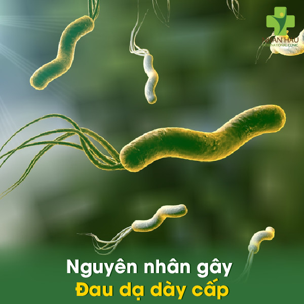 Đau dạ dày cấp: Nguyên nhân và triệu chứng của đau dạ dày cấp 1 Nguyên nhân gây đau dạ dày cấp