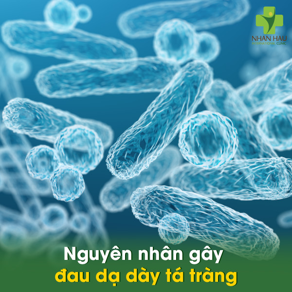 Đau dạ dày tá tràng: Tìm hiểu nguyên nhân và các triệu chứng 1 Nguyên nhân gây đau dạ dày tá tràng