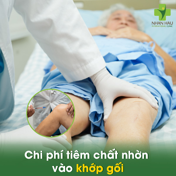 Tiêm chất nhờn vào khớp gối giá bao nhiêu? Bảng giá chi tiết và những điều cần biết 2 Chi phí tiêm chất nhờn vào khớp gối