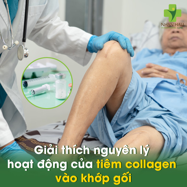 Tiêm collagen vào khớp gối: Giải pháp trẻ hóa và bảo vệ khớp gối hiệu quả 1 Giải thích nguyên lý hoạt động của tiêm collagen vào khớp gối