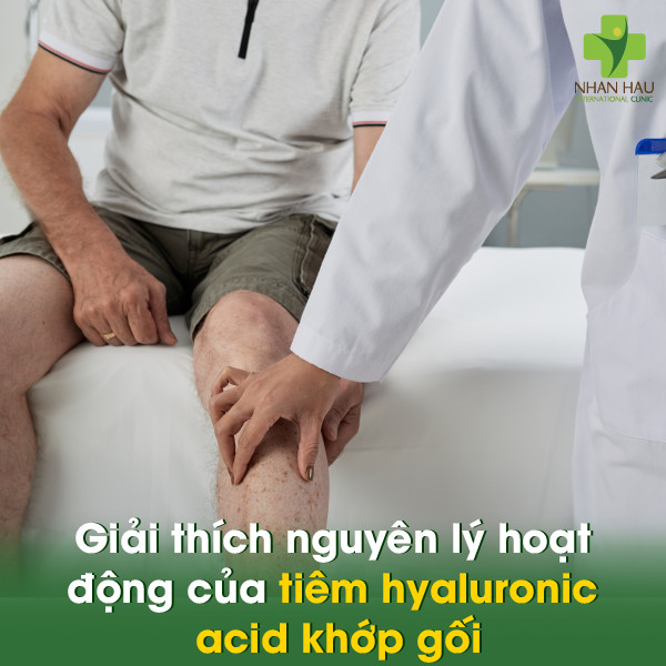 Tiêm Hyaluronic Acid Khớp Gối: Hiệu Quả, Chi Phí, Rủi Ro 1 Giải thích nguyên lý hoạt động của tiêm hyaluronic acid khớp gối