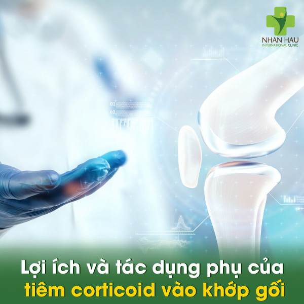 Tiêm corticoid vào khớp gối: Giải pháp giảm đau hiệu quả nhưng cần cẩn trọng 2 Lợi ích và tác dụng phụ của tiêm corticoid vào khớp gối