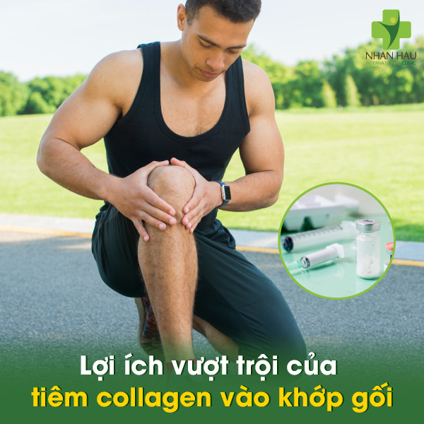 Tiêm collagen vào khớp gối: Giải pháp trẻ hóa và bảo vệ khớp gối hiệu quả 6 Lưu ý quan trọng khi tiêm collagen vào khớp gối