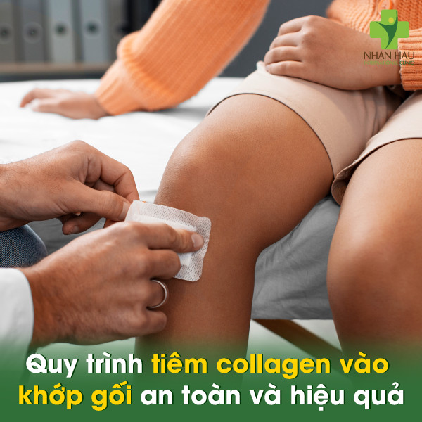 Tiêm collagen vào khớp gối: Giải pháp trẻ hóa và bảo vệ khớp gối hiệu quả 4 Quy trình tiêm collagen vào khớp gối an toàn và hiệu quả