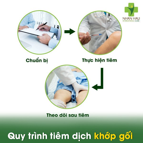 Tiêm dịch khớp gối có tốt không? Ưu điểm và nhược điểm khi tiêm 5 Quy trình tiêm dịch khớp gối: