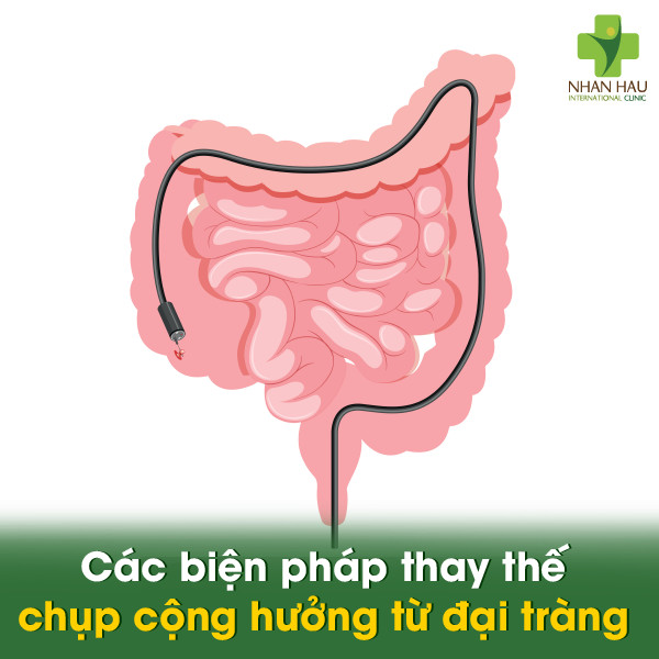 Chụp cộng hưởng từ đại tràng: Phương pháp hỗ trợ chẩn đoán hiệu quả 5 Các biện pháp thay thế chụp cộng hưởng từ đại tràng