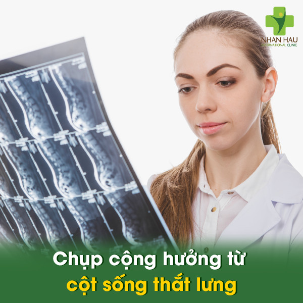 Chụp cộng hưởng từ cột sống thắt lưng: Giải đáp về chi phí, quy trình và ứng dụng 1 Chụp cộng hưởng từ cột sống thắt lưng