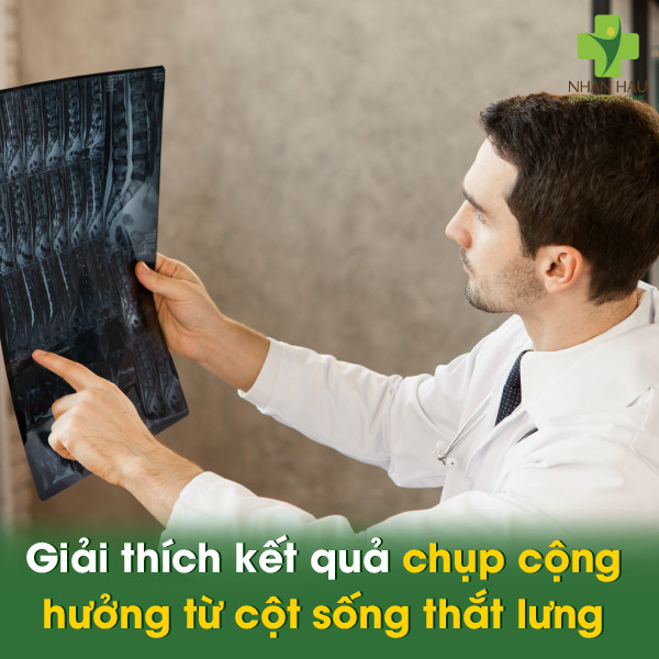 Chụp cộng hưởng từ cột sống thắt lưng: Giải đáp về chi phí, quy trình và ứng dụng 5 Giải thích kết quả chụp cộng hưởng từ cột sống thắt lưng