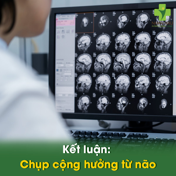 Kết luận: Chụp cộng hưởng từ não