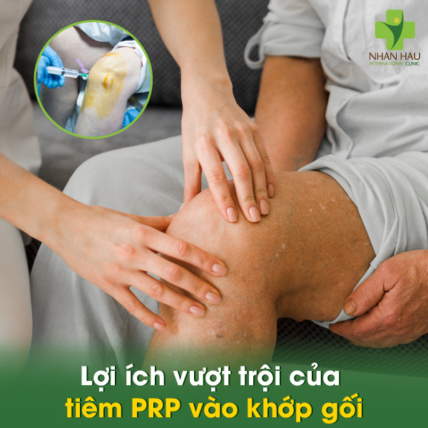 Tiêm PRP vào khớp gối (huyết tương giàu tiểu cầu): Giải pháp phục hồi sụn khớp hiệu quả 2 Lợi ích vượt trội của tiêm PRP vào khớp gối