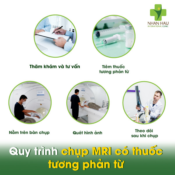 Chụp cộng hưởng từ có thuốc tương phản từ là gì: Ưu và nhược điểm của chụp MRI không tiêm thuốc tương phản từ 3 Quy trình chụp MRI có thuốc tương phản từ
