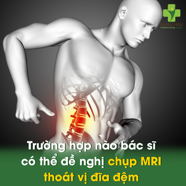 Trường hợp nào bác sĩ có thể đề nghị chụp MRI thoát vị đĩa đệm