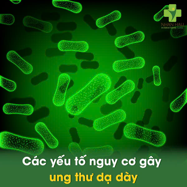 Những Dấu Hiệu Cảnh Báo Ung Thư Dạ Dày Bạn Không Nên Bỏ Qua 4 Các yếu tố nguy cơ gây ung thư dạ dày