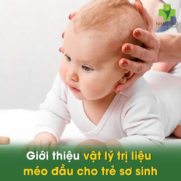 Vật lý trị liệu méo đầu cho trẻ sơ sinh: Giải pháp cải thiện cho con trẻ 1 Giới thiệu vật lý trị liệu méo đầu cho trẻ sơ sinh
