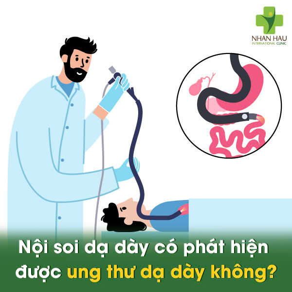 Nội Soi Dạ Dày Có Phát Hiện Ung Thư Dạ Dày Không? Giải Đáp Thắc Mắc 2 Nội soi dạ dày có phát hiện được ung thư dạ dày không