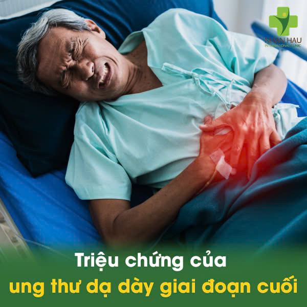 Ung Thư Dạ Dày Giai Đoạn Cuối: Cùng Tìm Hiểu Cách Điều Trị và Chăm Sóc 2 Triệu chứng của ung thư dạ dày giai đoạn cuối