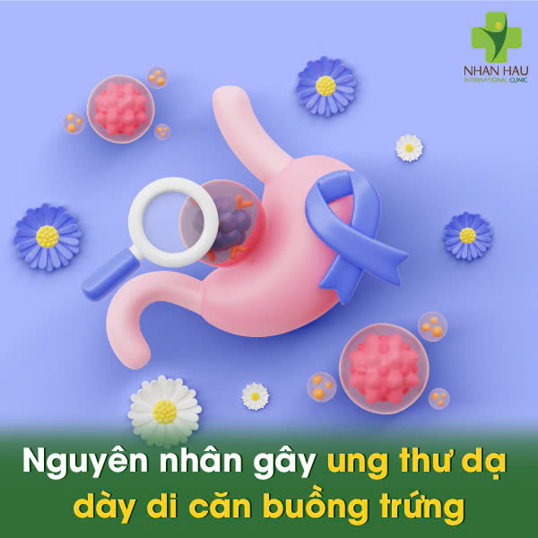 Ung Thư Dạ Dày Di Căn Buồng Trứng: Triệu Chứng, Nguy Cơ và Điều Trị 2 Nguyên nhân gây ung thư dạ dày di căn buồng trứng