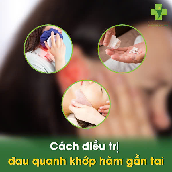 Đau Quanh Khớp Hàm Gần Tai: Phân Biệt Nguyên Nhân và Cách Khắc Phục 4 Cách Điều Trị Đau Quanh Khớp Hàm Gần Tai