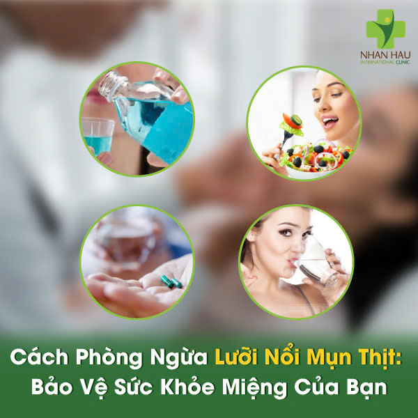 Lưỡi Nổi Mụn Thịt: Phân Biệt Loại Mụn, Nguyên Nhân và Cách Điều Trị Hiệu Quả 7 Cách Phòng Ngừa Lưỡi Nổi Mụn Thịt: Bảo Vệ Sức Khỏe Miệng Của Bạn
