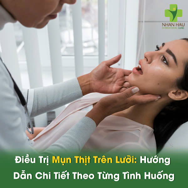 Lưỡi Nổi Mụn Thịt: Phân Biệt Loại Mụn, Nguyên Nhân và Cách Điều Trị Hiệu Quả 6 Điều Trị Mụn Thịt Trên Lưỡi: Hướng Dẫn Chi Tiết Theo Từng Tình Huống