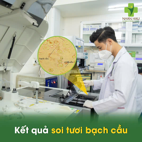Kết Quả Soi Tươi: Bạch Cầu, Thông Tin Bình Thường và Nấm 2 Kết quả soi tươi bạch cầu