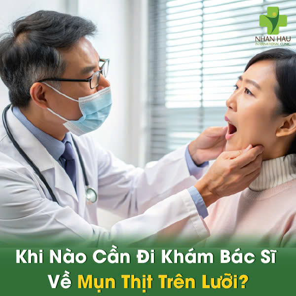 Lưỡi Nổi Mụn Thịt: Phân Biệt Loại Mụn, Nguyên Nhân và Cách Điều Trị Hiệu Quả 8 Khi Nào Cần Đi Khám Bác Sĩ Về Mụn Thịt Trên Lưỡi?
