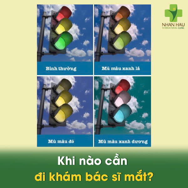 Kiểm Tra Nhanh với Bảng Kiểm Tra Mù Màu: Bạn Có Bị Rối Loạn Sắc Giác (Mù Màu) Không? 7 Khi nào cần đi khám bác sĩ mắt?