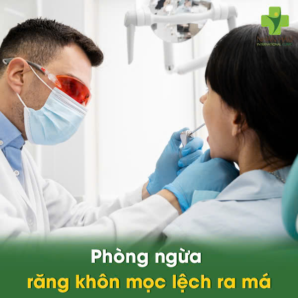 Răng Khôn Mọc Lệch Ra Má, Cắn Má - Đừng Chờ Đợi! Tìm Hiểu Nguy Hiểm Và Cách Xử Trí 6 Phòng ngừa răng khôn mọc lệch ra má
